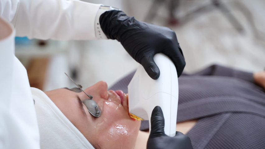 Facial treatment at clinic of aesthetic medicine with using BBL laser. Skin rejuvenation. Laser treats redness, sun damage, giving anti-aging effect. Non-invasive cosmetology at clinic | Shutterstock HD Video #1092564141