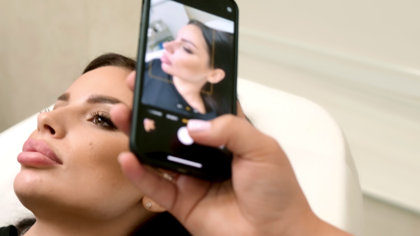The doctor takes a picture of the patient after the injection for lip augmentation. The cosmetologist injected hyaluronic acid into the girl's lips with a syringe and photographs the result
 | Shutterstock HD Video #1092680431