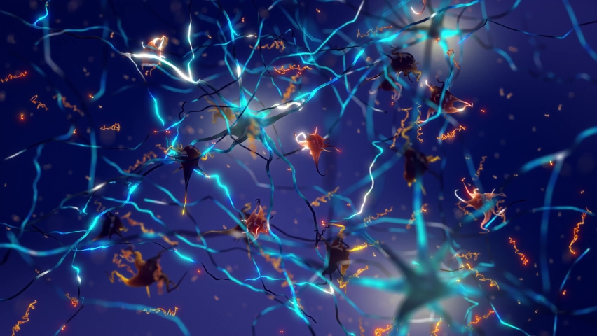 Amyloid plaques forming between neurons. Beta-amyloid protein disrupting nerve cells function in a brain with Alzheimer's disease Royalty-Free Stock Footage #1092806723