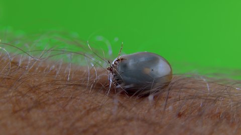 Parasite On Human Skin Tick Moves Stock Footage Video (100% Royalty ...