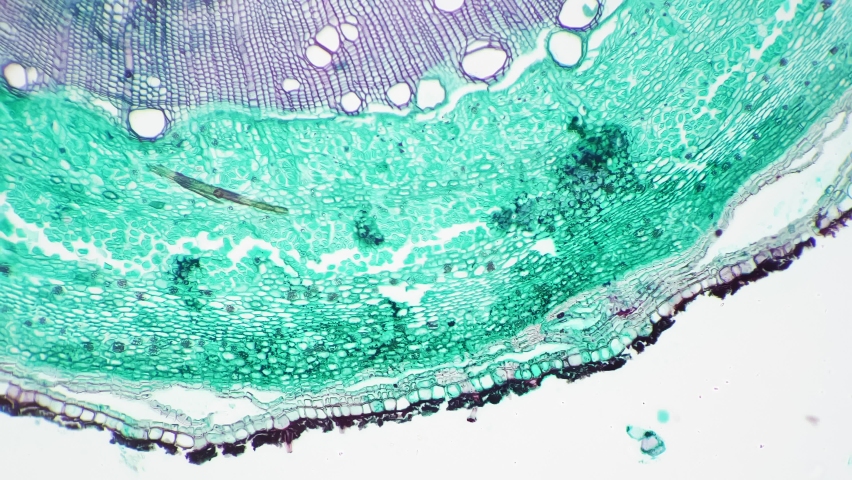 Scientific sample of stem of xylophyta dicotyledon in transversal section shown under microscope with 100 times magnification against bright field. Slide with a piece of plant for study in