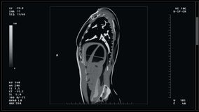 X-ray Scan By Modern Medical Radiology Equipment For Surgery. Using X-ray Scan To Check Organ Health For Surgery Procedure. X-ray Examination Scan Device Screen. Inspecting Patient For Surgery - Powered by Shutterstock - Get 15% off with code: PIKWIZARD15