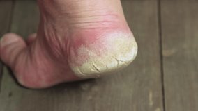 A flat file removes dead skin on the heel of a man's foot. The concept of male pedicure and foot care. Isolated video, gray background, close-up, warm light. UHD 4K.