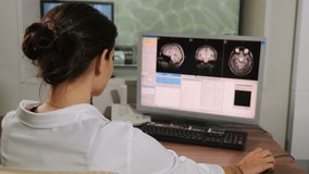 Doctor in Hospital Examining computer display or monitor while patient undergoing MRI brain procedure. MRI scanning. healthcare. Magnetic resonance, Disease diagnostics. Medical equipment. 4 k video
