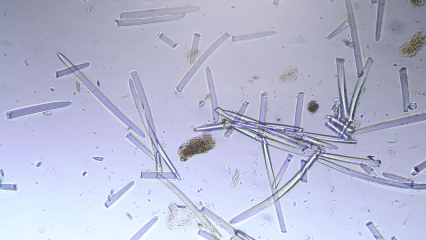 Spincule of Spongia whole mount under microscope 200x on white background. Spines of underwater organic sponge magnified in many times by scientific equipment on bright field. Sea life research