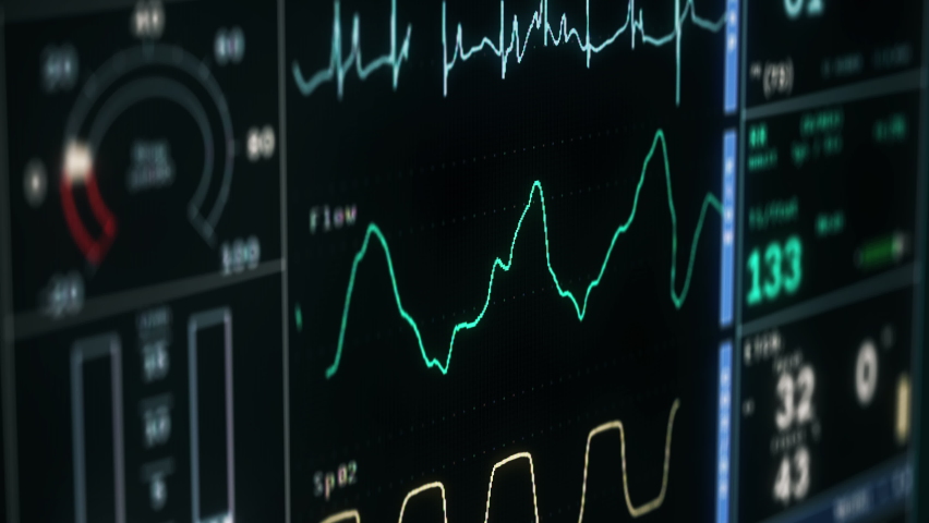 Examining the medical graph of the vital health signs. Medical equipment studies the rate of vital life signs. Medical system detects the rapid decline in the vital signs of a patient. Pulse. Royalty-Free Stock Footage #1094073449