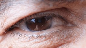 Eye of an elderly man with cataracts, clouding of the lens, macro video.