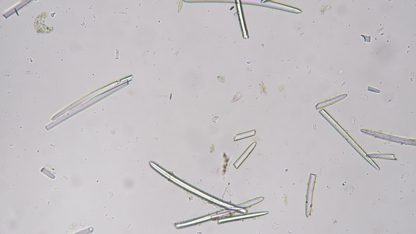 Spongia Spincule whole mount filmed under microscope with 100 times magnification and cross light. Underwater organism in static condition for educational issue and biological experiments. Marine life