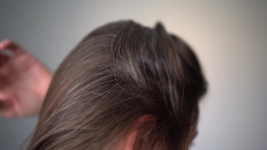 Gray hairs on the head of a young girl. Long gray hair. The initial stage of gray hair. The problem of gray hair in women. Royalty-Free Stock Footage #1094388087