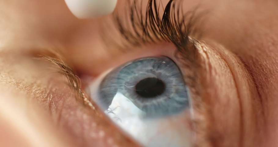 ME18-02-R-25. Eye drops, eye care and medicine in medical treatment. Tired eyes, irritation and allergies relief. Close up, zoom and macro shot of young woman applying eye drop for optical symptoms. Royalty-Free Stock Footage #1094526893