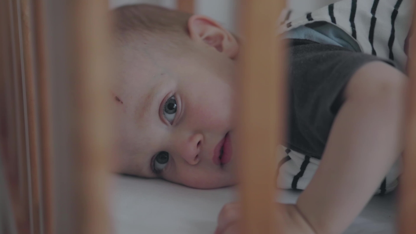 scared baby lying in wooden crib falling asleep with wound on forehead. child kid toddler boy in striped clothes lookin to camera with opened eyes. sadness, loneliness, alone baby, bedtime sleep