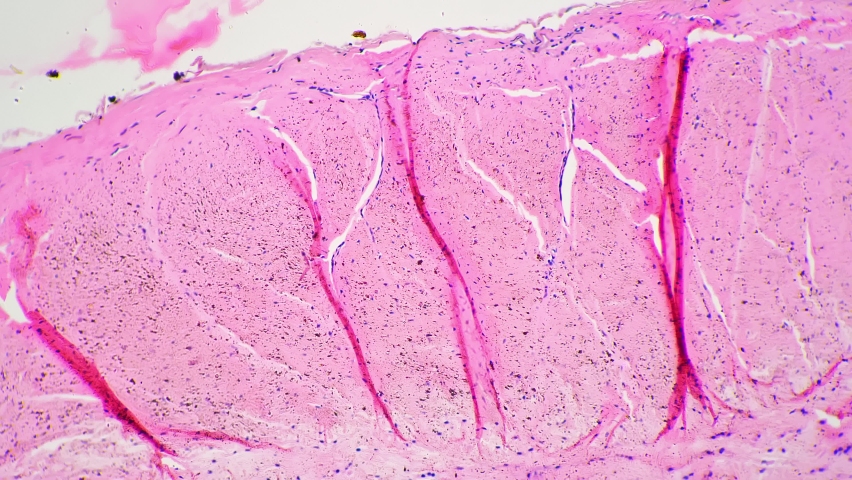 Dense connective tissue in longitudinal section under microscope 100x on bright field. Macro footage of human tendon with membranes and cells multiply magnified in lab for education. Anatomy theme Royalty-Free Stock Footage #1094544791