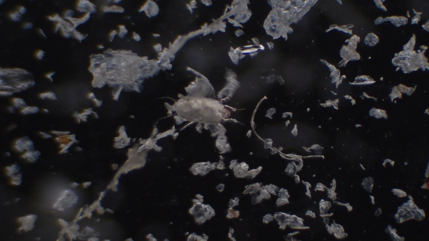House dust and mites observed under a microscope Royalty-Free Stock Footage #1094552249