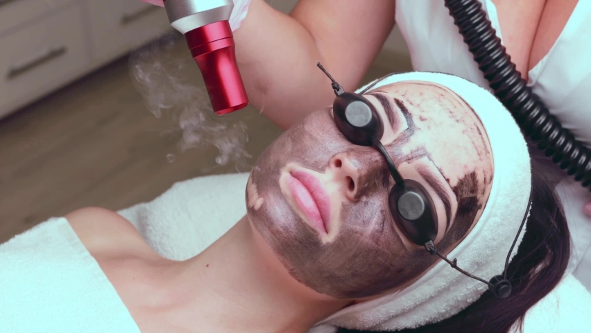 Beautician doing hardware carbon peeling to a young beautiful client in a headdress in goggles lying on a sofa in a beauty salon. Facial cleansing concept. Cosmetology services Royalty-Free Stock Footage #1094655737