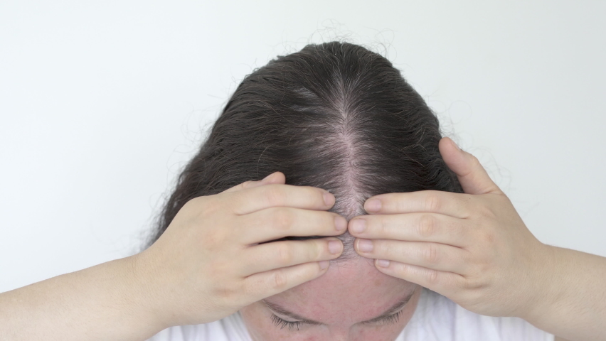 Close up of woman controls hair loss and little volume with fine hair against a white background  | Shutterstock HD Video #1094729703