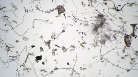 Mites House Dust Observed Under Microscope Stock Footage Video (100% ...