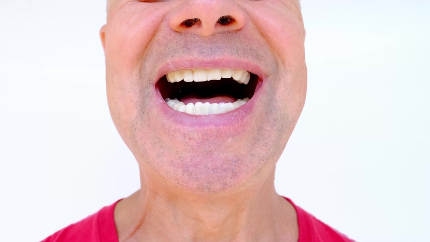 close-up of mature charismatic man, senior 60 years in dental office, open mouth, showing teeth with temporary dental crowns, oral cavity before prosthetics, concept dental treatment Royalty-Free Stock Footage #1094794915
