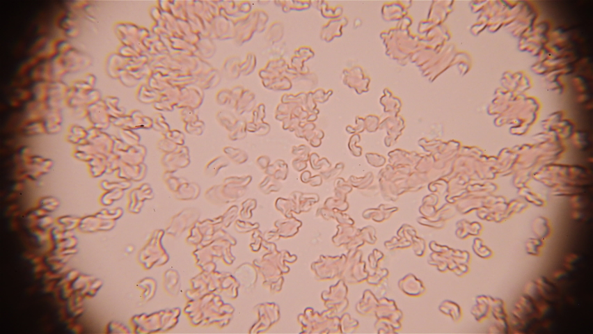 Many of the blood cells is moving in liquid. Close up view under the microscope.