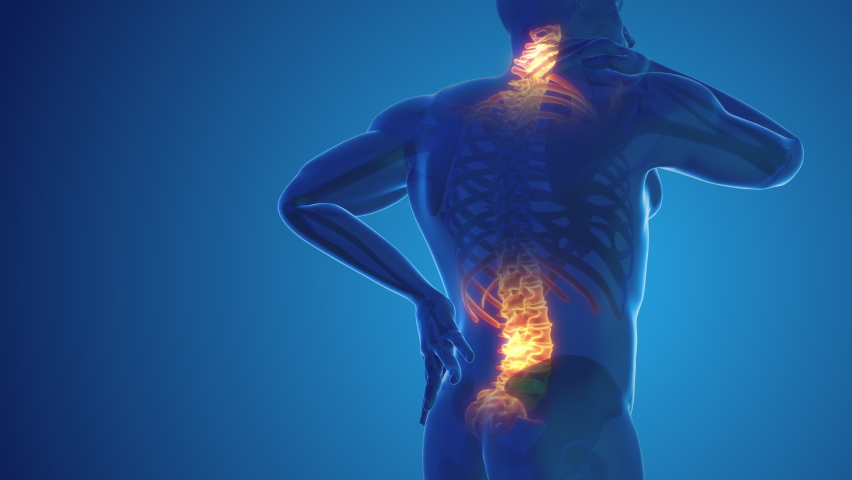 Pain in the back and neck joint Royalty-Free Stock Footage #1095311429