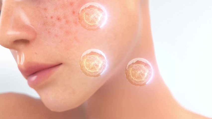 Showcase your combination of vitamins in skin care that protects your face and eliminates acne 3D. | Shutterstock HD Video #1095436709