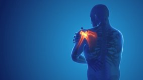 Pain in the shoulder joint 4k video.