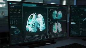 CT Images Of Lungs In Advanced Computer Software To Be Analyzed For Covid-19 Diagnose. 3d Visualization Of The Organ. Revealing Respiratory Infection. Data Processing. Medical CT Research. CT research - Powered by Shutterstock - Get 15% off with code: PIKWIZARD15