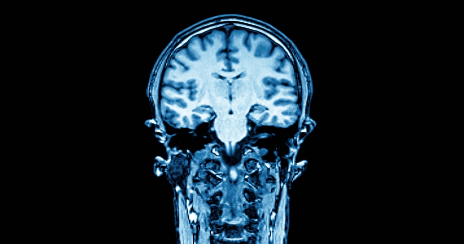 Medical scan showing human body part while scanning