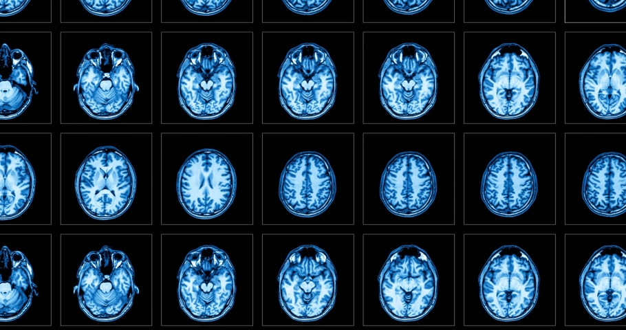 Several medical scans showing in motion