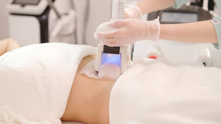 Сryolipolysis fat treatment procedure in the modern cosmetology clinic