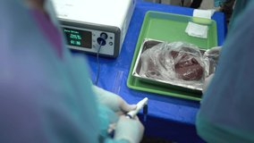 The medical team of surgeons in the hospital examined the pig's liver. doctor in operating room Professional surgeon raw liver HLG video file.
