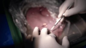 The medical team of surgeons in the hospital performs a pig liver operation. doctor in operating room. professional surgeon. raw liver. Video HLG File.