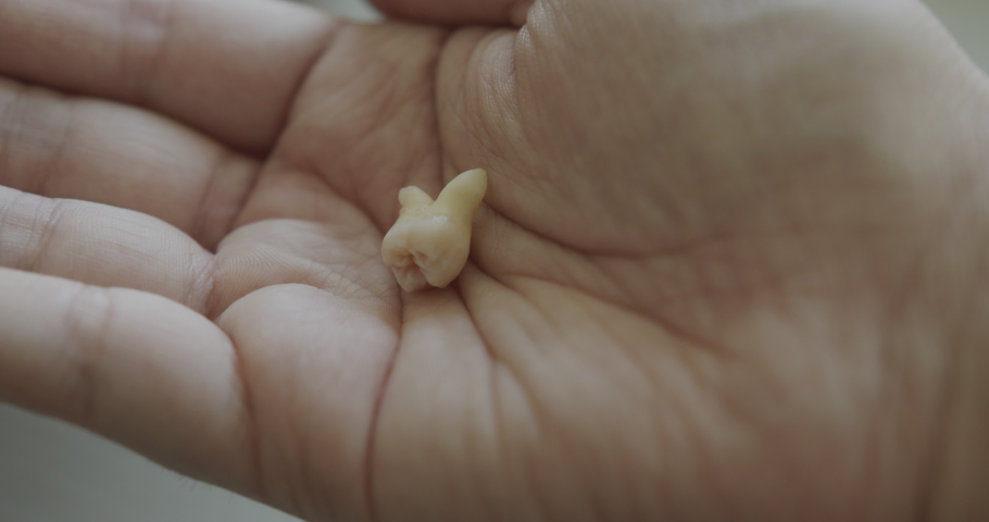 Close Up Slow Motion of a Wisdom Tooth in a Man's Hand Royalty-Free Stock Footage #1096094865