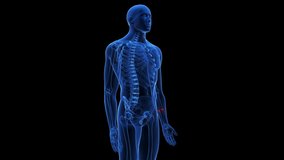 3d rendered medical animation of a broken lower arm - Powered by Shutterstock - Get 15% off with code: PIKWIZARD15