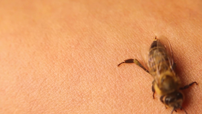 Honey bee stings a man's arm.
When the sting, the honeybee leaves the venom sac.
Note: It's still injecting the venom on its own (venom sac).
Bees, insects, bugs.
Allergy to insect stings, Honeybees Royalty-Free Stock Footage #1096255005