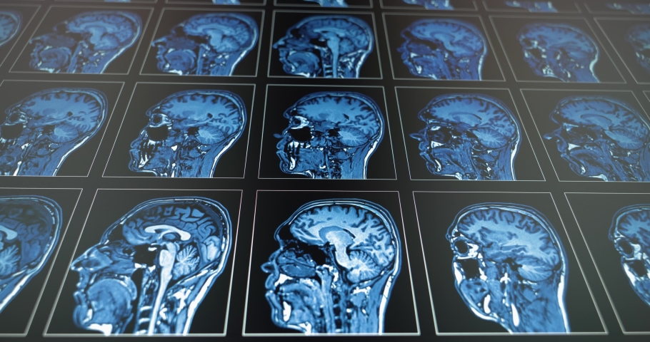 Several medical scans showing in motion