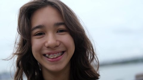 Стоковое видео: Portrait of a young girl who smiles happily with braces on her teeth. Portrait of a teenager on a city street