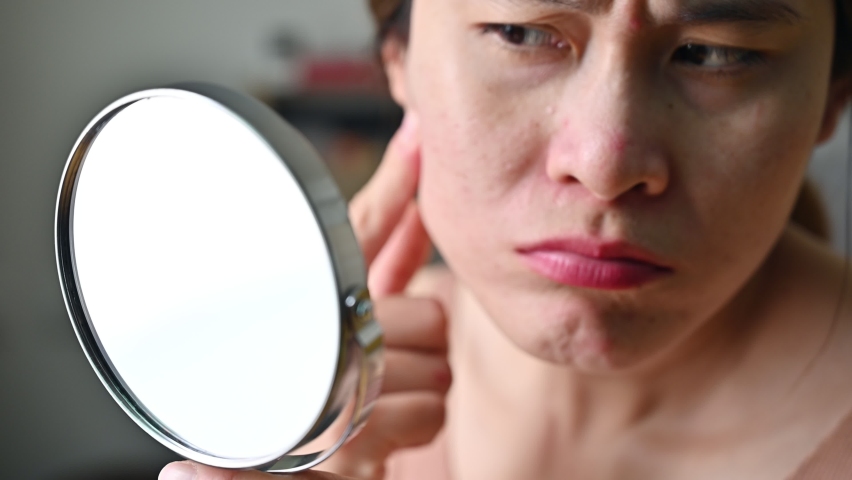 Asian woman worried about her face when she saw acne and wrinkled occur on her face by mini mirror. Allergies, irritants, genetic makeup, etc can cause skin conditions. Royalty-Free Stock Footage #1097015365