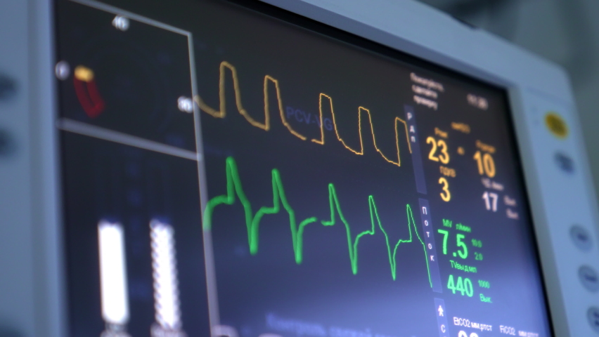 Green and orange curves running on the black screen of medical equipment. Close up. Life signs op the patient at surgery. Royalty-Free Stock Footage #1097086769