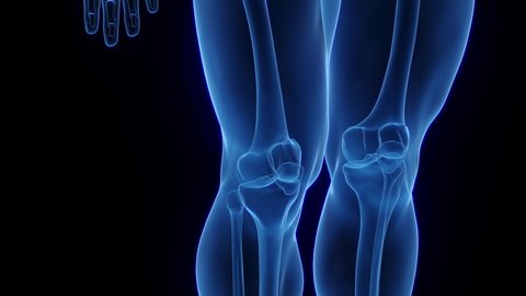 89 Inflamed Knee Stock Video Footage - 4K and HD Video Clips | Shutterstock