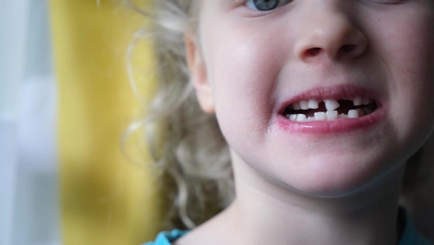 Little blond girl touching and showing milk tooth in toothless mouth. New tooth formation and milk baby tooth extraction. | Shutterstock HD Video #1097190751