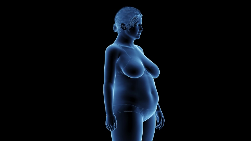 3d rendered medical animation of a woman