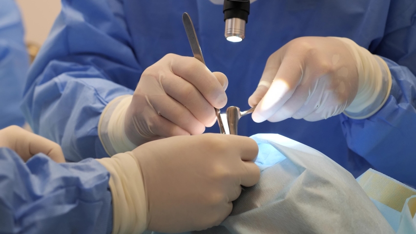 Two surgeons makes a man rhinoplasty nose surgery. Plastic Surgeon Operates On A Patient. Professional doctors do plastic cosmetic operation for male patient on the operating table in a modern clinic. Royalty-Free Stock Footage #1097484097