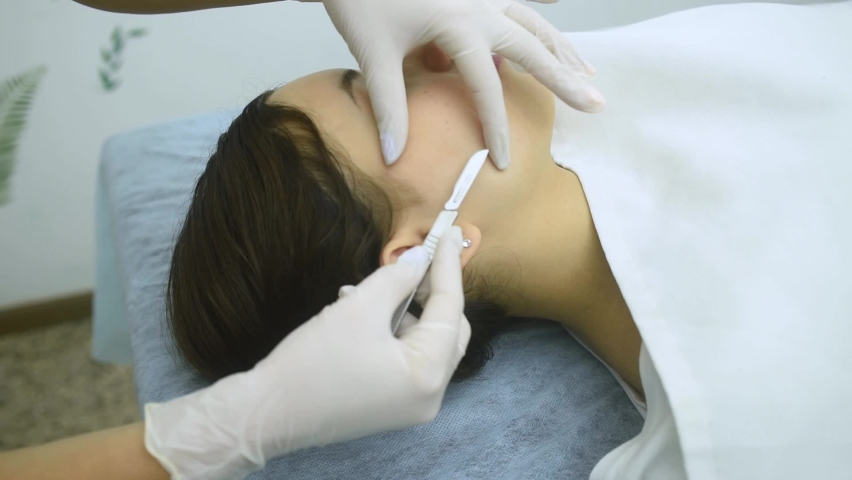 skin treatment with the dermaplaning technique performed with a scalpel by a beautician in a center of aesthetics and beauty of the body and skin Royalty-Free Stock Footage #1097621497