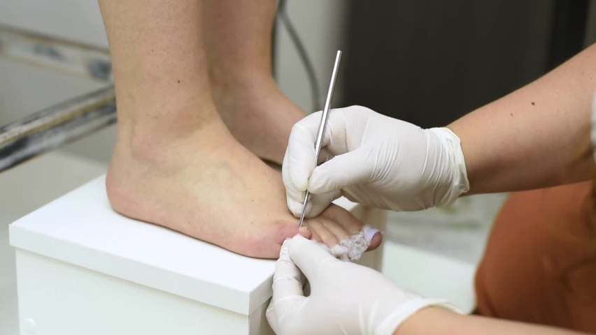 Complete treatment of pedicure and podiatry for health, aesthetics and beauty of the feet and nails in an aesthetic center with a scalpel, file and creams