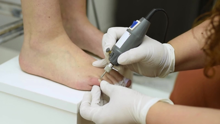 Complete treatment of pedicure and podiatry for health, aesthetics and beauty of the feet and nails in an aesthetic center with a scalpel, file and creams