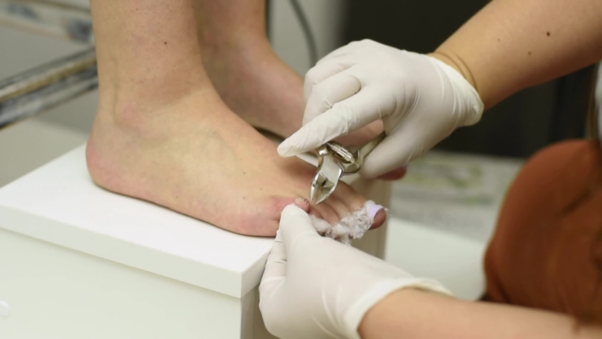 Complete treatment of pedicure and podiatry for health, aesthetics and beauty of the feet and nails in an aesthetic center with a scalpel, file and creams