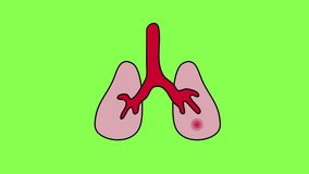 Organ lungs sick. Inflammation, pneumonia, disease. Logo on green chroma key background video 4k looped new