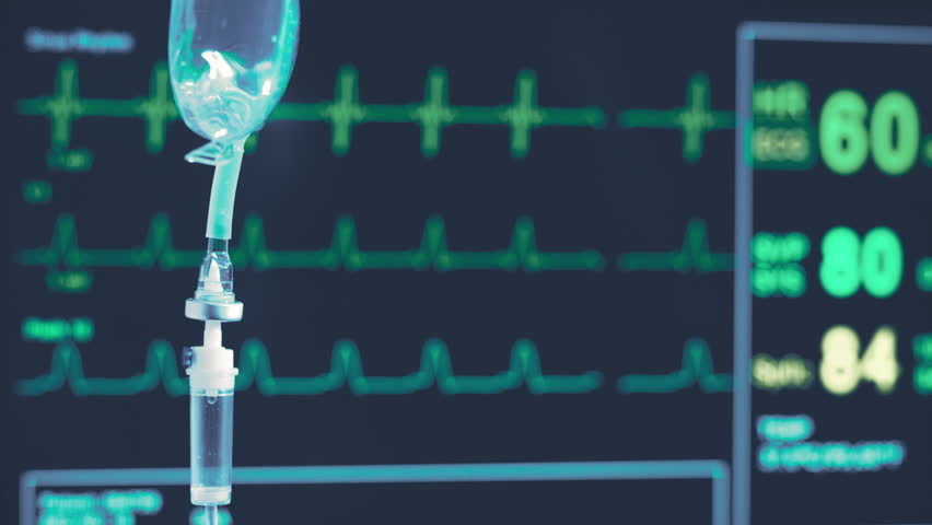 IV drip on the background of monitoring ECG, Closeup of IV drip in hospital, Intravenous saline solution Royalty-Free Stock Footage #1098162259