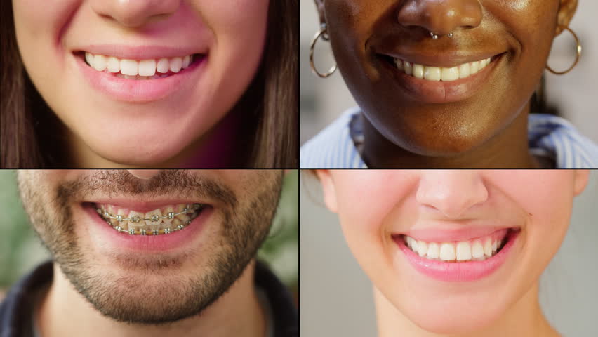 Collage portrait of Dental Smiling mix raced young professionals people or students, happy young international group, man and woman smiling portraits, happy people eyes. 