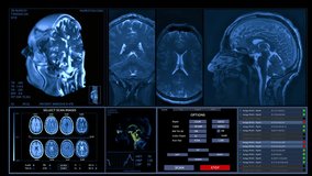 MRI brain scanning animation. Neurology data, vital signs on display Future technology. HUD, interface.  - Powered by Shutterstock - Get 15% off with code: PIKWIZARD15